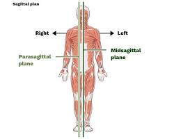 Image of Par sagittal plane anatomy