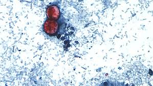 Cyclospora Cayetanensis