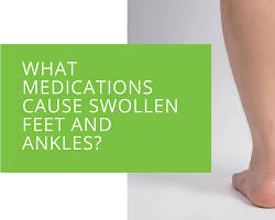 Swollen ankles and feet due to medications