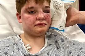 Woman attacked at Carpentersville McDonald’s ‘fought really hard’ for hate crime charge