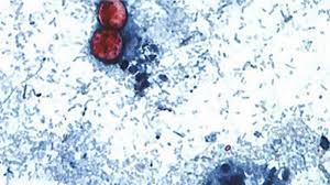 Cyclospora