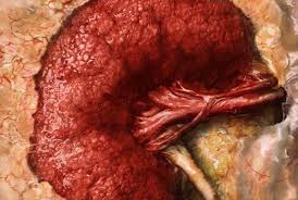 Image result for kidney disease