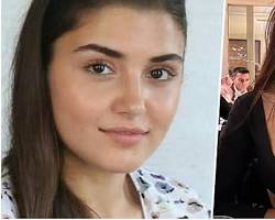Hande Erçel estetiksiz ve estetikli hali karşılaştırma resmi