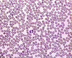 Image of Red blood cells under a microscope