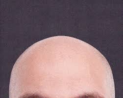 Going bald? There’s a subreddit for that – and it’s weirdly wonderful