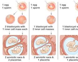 Image de Identical twins development stages