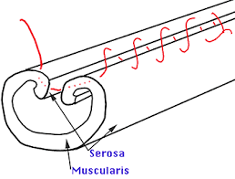 Image result for simple continuous suture pattern