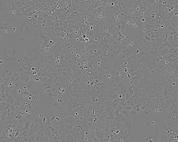 Image of Ishikawa cell line
