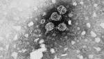  300 million hepatitis B sufferers but only one in 20 treated: study