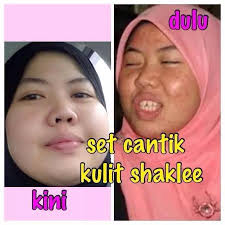 Image result for testimoni esp shaklee untuk kulit