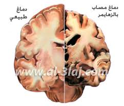 اضغط على الصورة لرؤيتها بالحجم الطبيعي