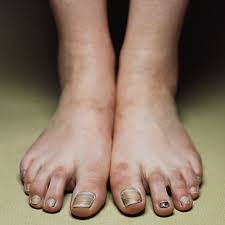 Image result for ugly women's feet