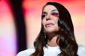 Durante show, Ivete Sangalo detalha acidente e fala sobre ida ao hospital: 'Vai dar certo'