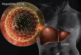 Image result for HEPATITIS PREVENTION TIPS