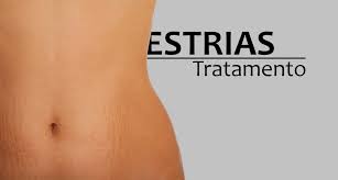 Resultado de imagem para estrias