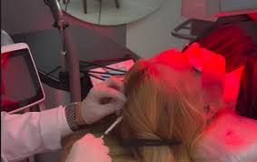 Virginia Fonseca revela volta de doença crônica: entenda o que é a alopecia areata e seus gatilhos