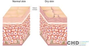 Image result for dry skin