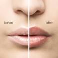 Do Lip-Plumping Products Work? - WebMD