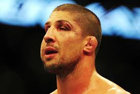 Saturday&#39;s UFC 174 event left Brendan Schaub with two unfortunate parting gifts: a controversial split-decision loss, and a weird grapefruit-sized swelling ... - brendan-schaub-ufc-1742