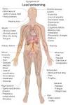 Lead poisoning: MedlinePlus Medical Encyclopedia