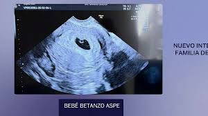 Nuevo Integrante de la Familia Despierta: Alix Aspe Anuncia Así la Noticia de su Embarazo