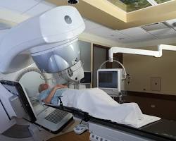 Image of Linear accelerator radiation therapy machine