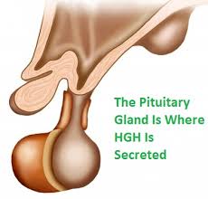 Resultado de imagem para GH deficiency associated with deficiencies of other pituitary hormones
