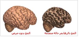 اضغط على الصورة لرؤيتها بالحجم الطبيعي