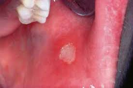 images?q=tbn:ANd9GcTkZ2f2xEkiVj7F0HFyyzAgh4Ea37S tlM47deLBrctpVVLGdRH