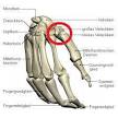 Fingerarthrose: Bei Arthrose der Fingergelenke gibt es zahlreiche