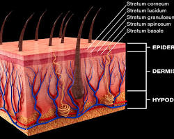 Image of three layers of the skin: epidermis, dermis, and hypodermis