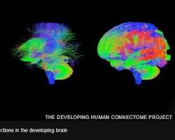 صورة neural connections in baby's brain