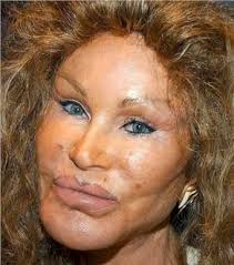 ... Jocelyn still has a long way to go. Read more about Jocelyn Wildstein&#39;s plastic surgery procedures. Jocelyn Wildenstein, Plastic Surgery - Jocelyn-wildenstein-plastic-surgery