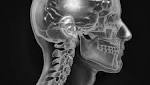  Treatments for Alzheimer's disease continue to evolve