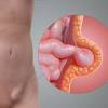 Story image for Obat Kulit Manggis Daun Sirsak from Harian Post