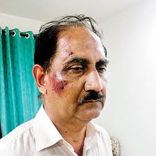 Chaitraly Deshmukh DNA. Wing commander (retd) Arun Laxmanrao Deshmukh was allegedly beaten up mercilessly by Congress MLA Vinayak Niham over a land issue in ... - 1858306