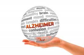 Risultati immagini per alzheimer
