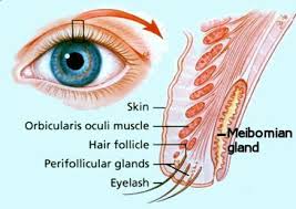 Kalazion (Chalazion)