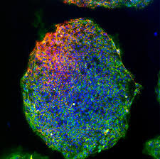 Are We on the Brink of Ending Aging?