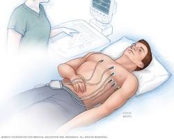 Image of Electrocardiogram (ECG)