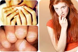 Resultado de imagem para roer unhas