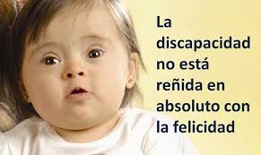 Resultado de imagen para sindrome de down