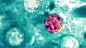 COUNTY-BY-COUNTY: Diarrhea-causing parasite flares up across Central Florida