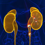  Oral antibiotics may raise risk of kidney stones