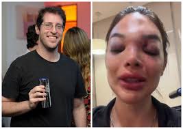 Dentista relata ao 'Fantástico' agressões que sofreu do marido, empresário da Faria Lima