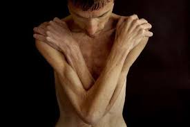 Hasil gambar untuk Identify Anorexia and Bulimia