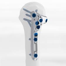 PGR Proximal humerus | Intrauma