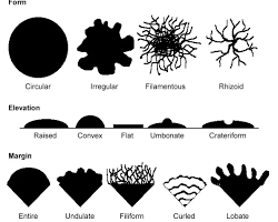 Image of Irreguler bacterial colony