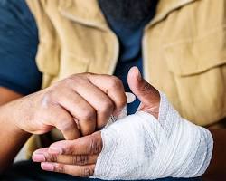 Image of Injury