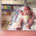 Baby born with Zika-related complications in Miami-Dade